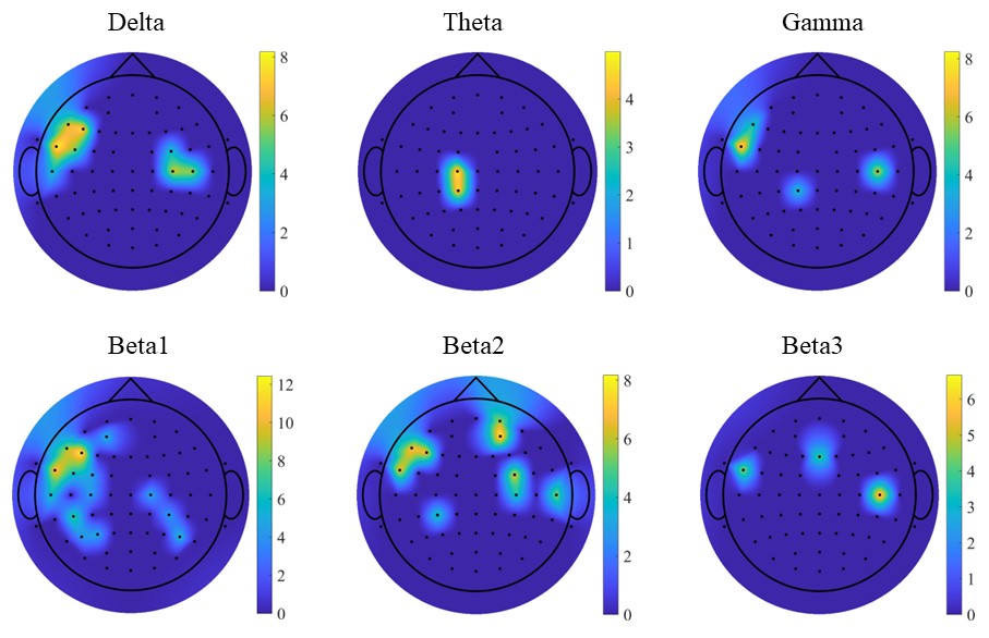 Figure 1. Topographic map of t-value distribution