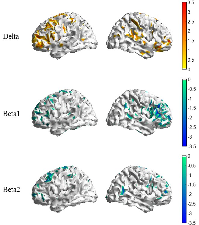 Figure 4. Connection strength matrix